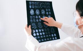 Na czym polega badanie MRI i jak się do niego przygotować? - art. sposn.